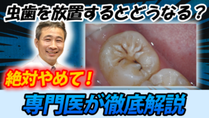 【危険！】虫歯を放置すると起こること