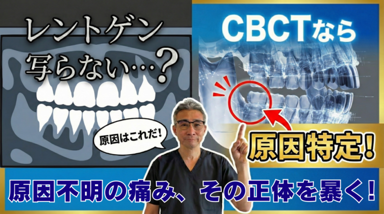 CBCT（歯科用3Dレントゲン）で“見えない原因”が見えるようになる理由とは？