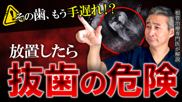 根管治療はあと何回通えば終わる？専門医が「短期で終わる理由」を解説
