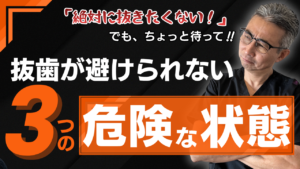 歯を抜きたくない人へ。専門医が語る“抜歯が避けられない3つの状態”