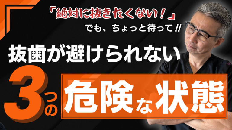 歯を抜きたくない人へ。専門医が語る“抜歯が避けられない3つの状態”